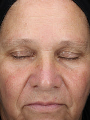 Close up of face before using product